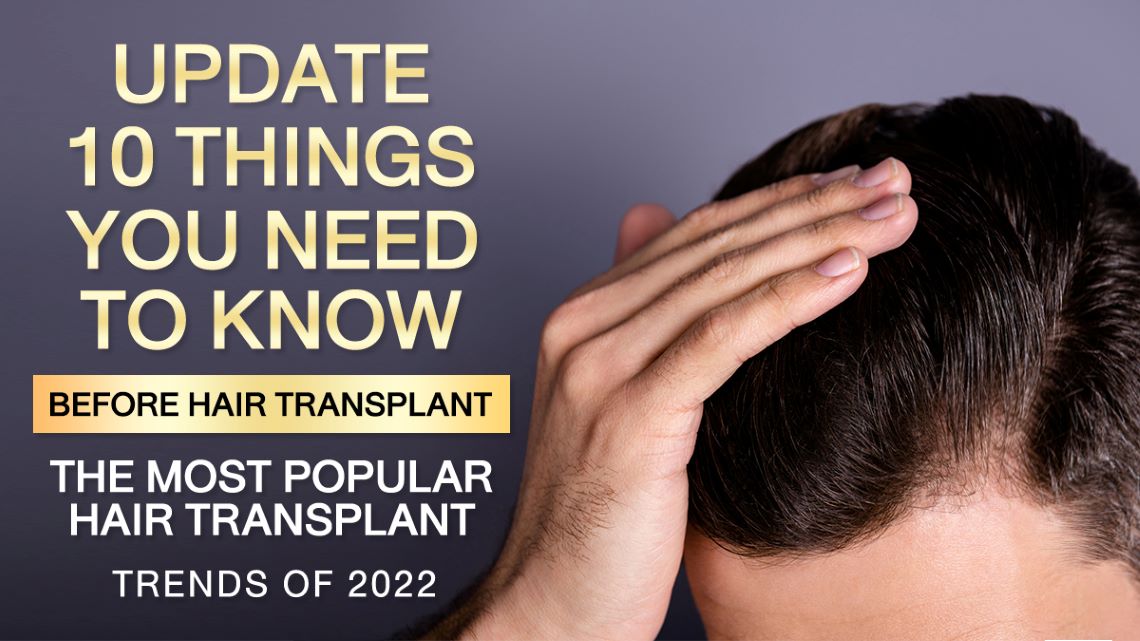 Update 10 things you need to know before hair transplant the most popular  hair transplant trends of 2021