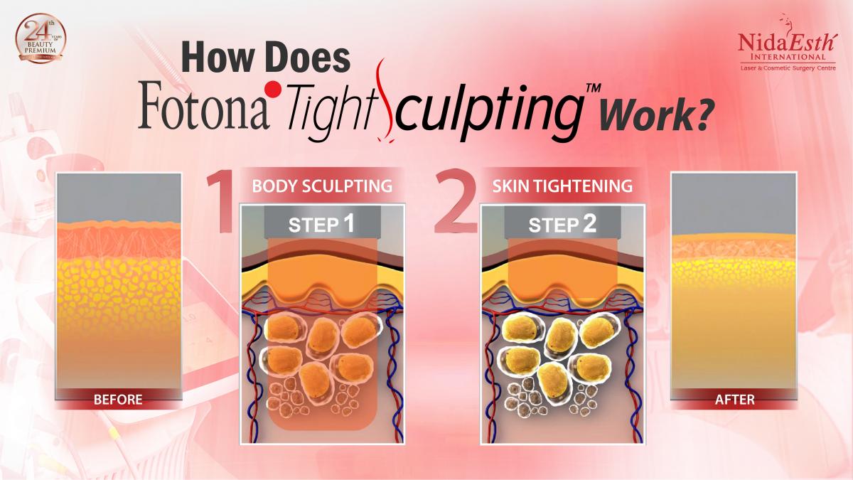 How does it work TightSculpting