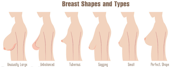 Update 10 things you should know before breast surgery And the